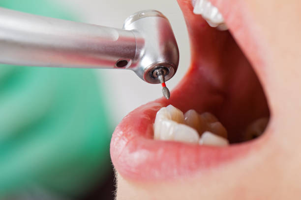 Best Cracked Tooth Emergency Dentist  in Colonia, NJ